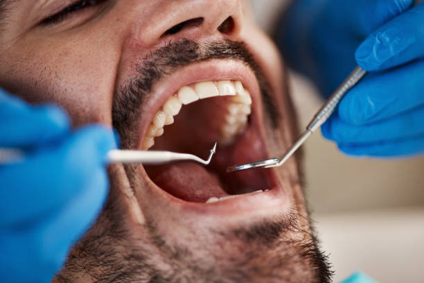 Best Broken or Chipped Tooth Repair in Clarendon Hls, IL